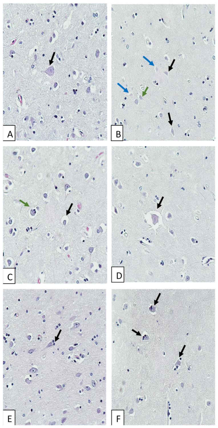 https://cdn.ncbi.nlm.nih.gov/pmc/blobs/f233/10216380/5146302d5143/biomedicines-11-01407-g001.jpg