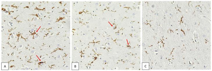 https://cdn.ncbi.nlm.nih.gov/pmc/blobs/f233/10216380/c8763cef3ee0/biomedicines-11-01407-g003.jpg
