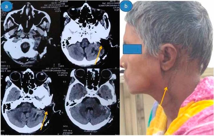 https://cdn.ncbi.nlm.nih.gov/pmc/blobs/f234/9830093/5a83e2e818de/10.1177_20363613221150218-fig3.jpg