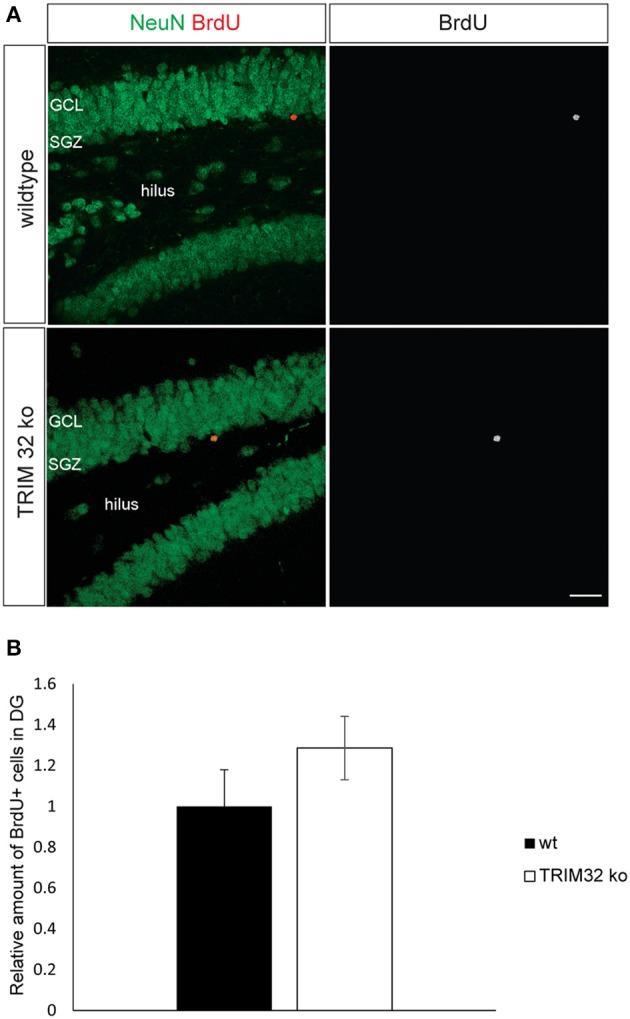 https://cdn.ncbi.nlm.nih.gov/pmc/blobs/f235/4364253/64cba9c67f29/fncel-09-00075-g0002.jpg