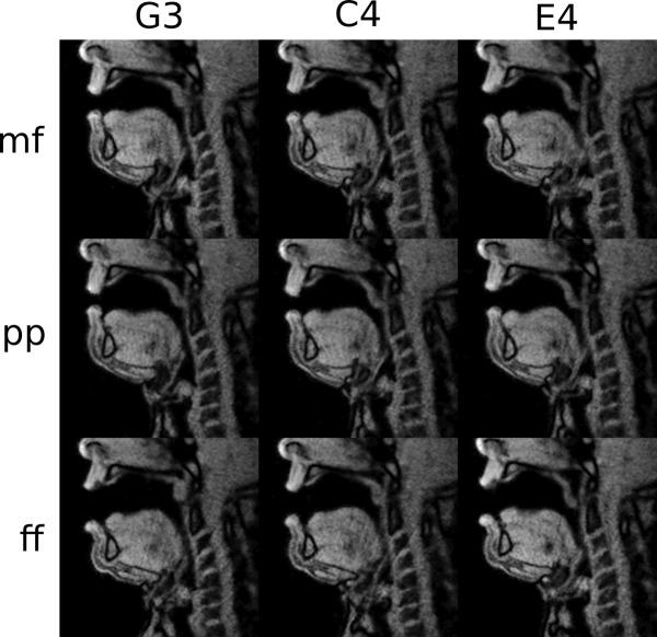 https://cdn.ncbi.nlm.nih.gov/pmc/blobs/f236/4838265/b74836738a92/pone.0153792.g004.jpg
