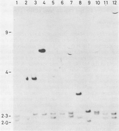 https://cdn.ncbi.nlm.nih.gov/pmc/blobs/f23b/1050406/d3d2838faf01/jmedgene00086-0049-a.jpg
