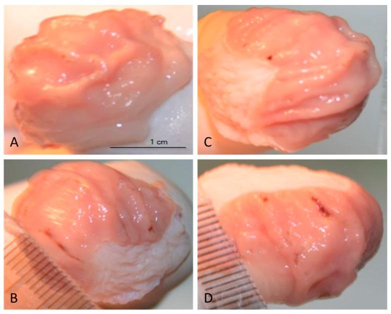 https://cdn.ncbi.nlm.nih.gov/pmc/blobs/f23f/5852835/6c498f0450a1/nutrients-10-00259-g005.jpg
