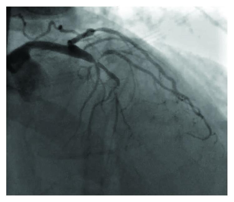 https://cdn.ncbi.nlm.nih.gov/pmc/blobs/f23f/6136583/514088b5e75d/CRIC2018-6857318.001.jpg