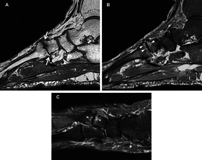https://cdn.ncbi.nlm.nih.gov/pmc/blobs/f242/10952448/f84a87a96f4d/ACR-75-1113-g002.jpg