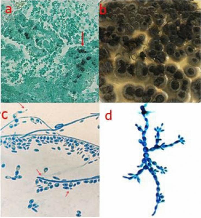 https://cdn.ncbi.nlm.nih.gov/pmc/blobs/f244/9124166/0436284e8dd5/11046_2022_623_Fig2_HTML.jpg