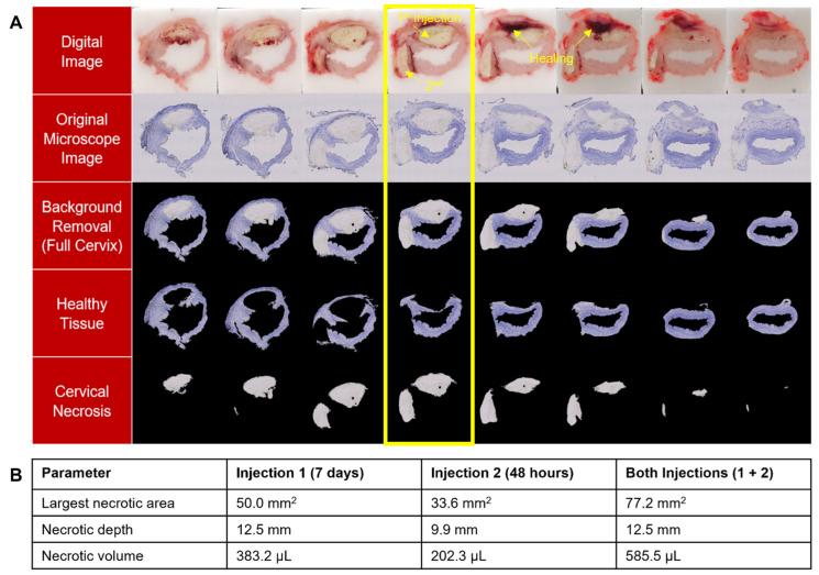https://cdn.ncbi.nlm.nih.gov/pmc/blobs/f245/10669649/8efc106c25d1/bioengineering-10-01246-g008.jpg