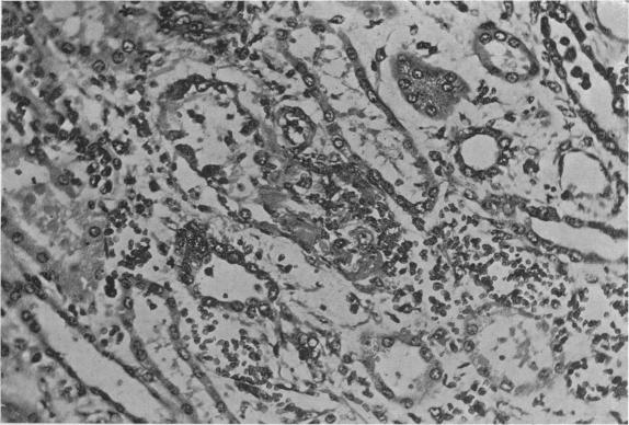 https://cdn.ncbi.nlm.nih.gov/pmc/blobs/f256/2161734/427817e64ffa/brmedj04085-0007-b.jpg