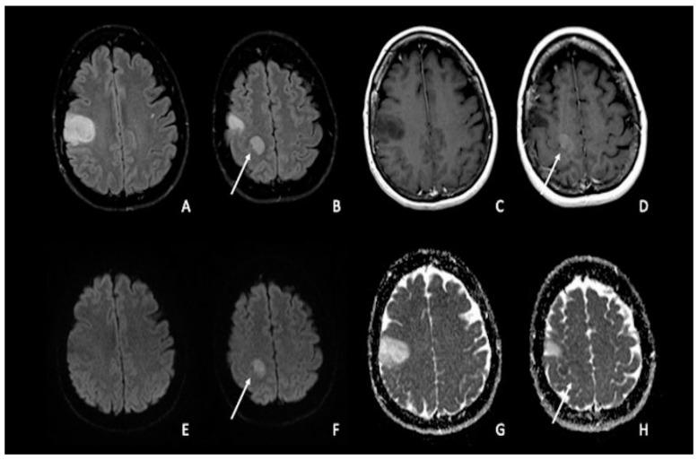https://cdn.ncbi.nlm.nih.gov/pmc/blobs/f25b/9913305/88483584a866/cancers-15-00618-g001.jpg