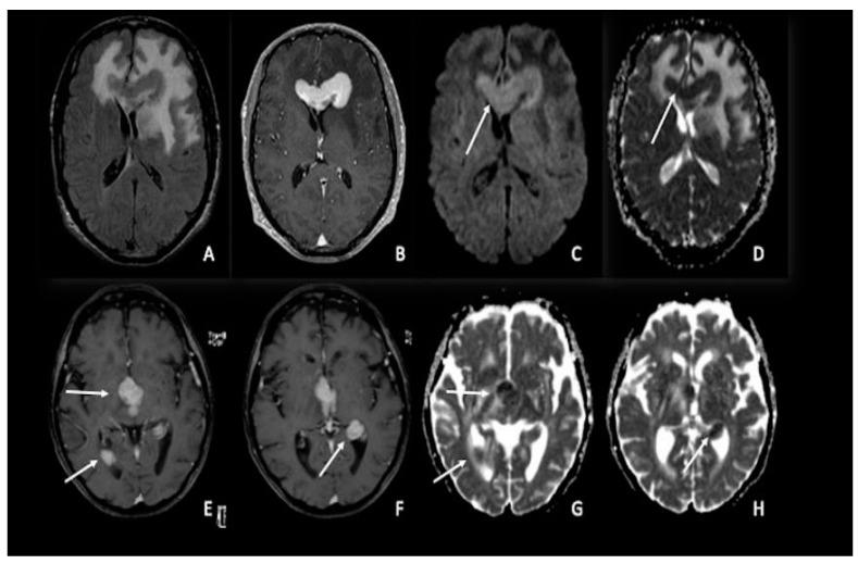 https://cdn.ncbi.nlm.nih.gov/pmc/blobs/f25b/9913305/b4d78bee89b7/cancers-15-00618-g003.jpg