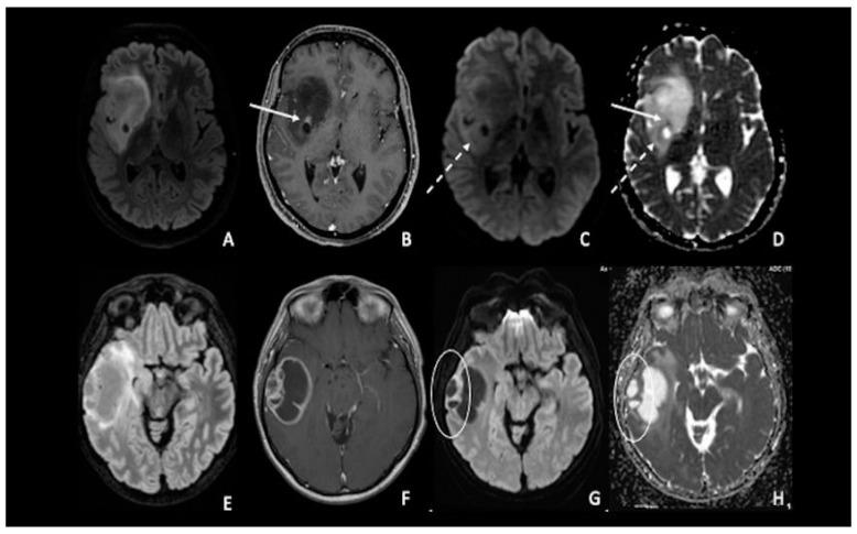 https://cdn.ncbi.nlm.nih.gov/pmc/blobs/f25b/9913305/b52bcc329f72/cancers-15-00618-g002.jpg