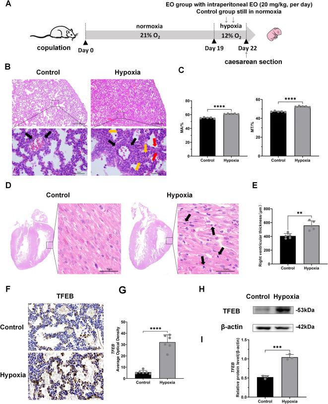 https://cdn.ncbi.nlm.nih.gov/pmc/blobs/f260/12223042/7d5230092f6e/41598_2025_7068_Fig1_HTML.jpg