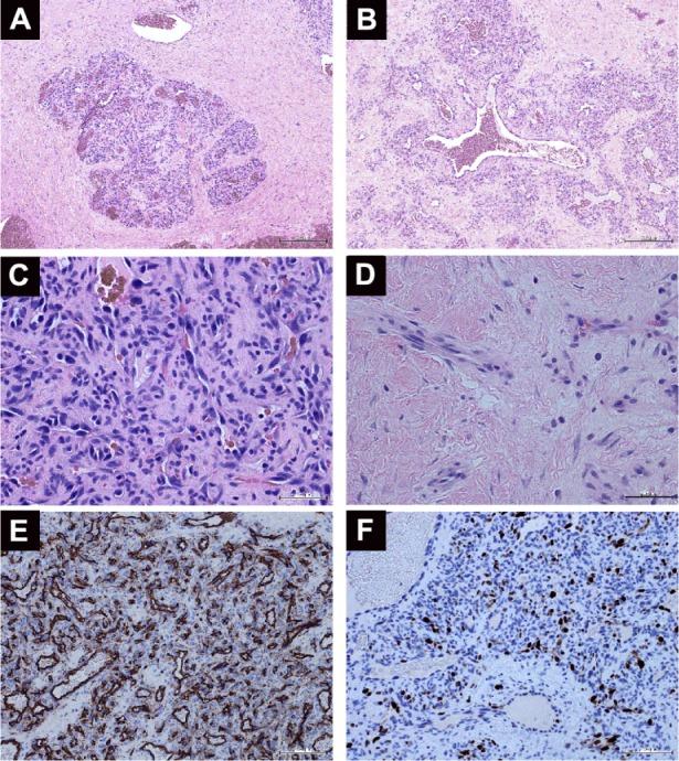 https://cdn.ncbi.nlm.nih.gov/pmc/blobs/f264/3862697/40fbf76b33bd/opth-8-031Fig2.jpg
