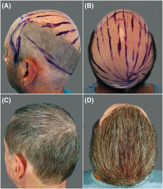 https://cdn.ncbi.nlm.nih.gov/pmc/blobs/f269/10904000/ed3d461e59b2/ds-50-306-g001.jpg