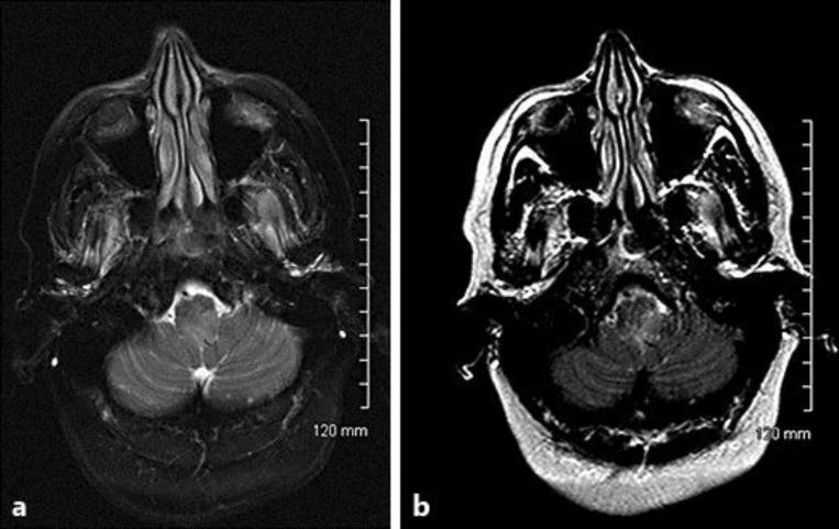 https://cdn.ncbi.nlm.nih.gov/pmc/blobs/f272/4154191/586fe590ce2c/cro-0007-0471-g03.jpg