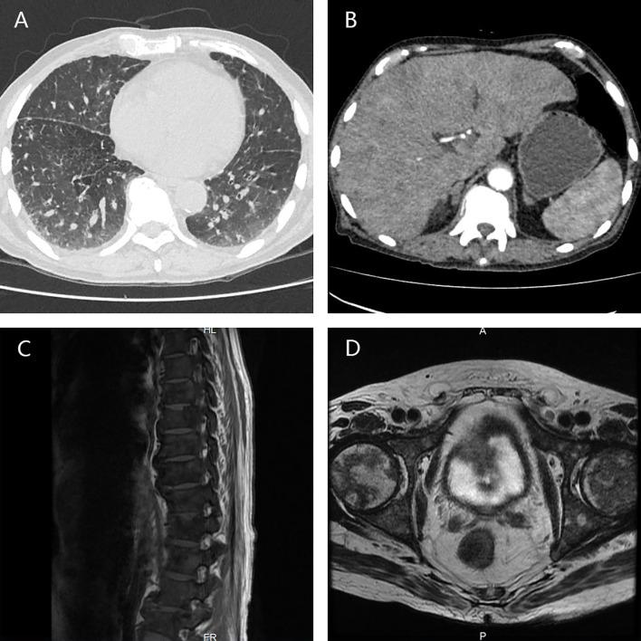 https://cdn.ncbi.nlm.nih.gov/pmc/blobs/f275/8107685/a442c9105ee4/fonc-11-659442-g002.jpg