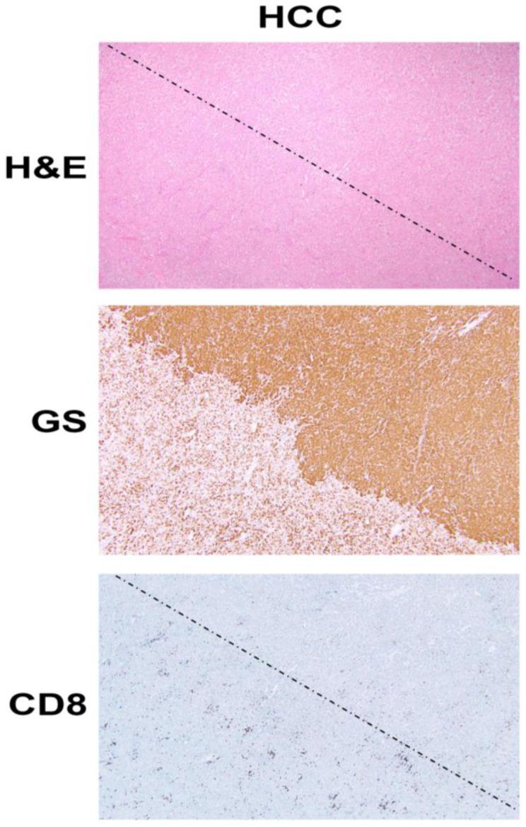 https://cdn.ncbi.nlm.nih.gov/pmc/blobs/f276/8069637/8e3980cc833b/cancers-13-01830-g001.jpg