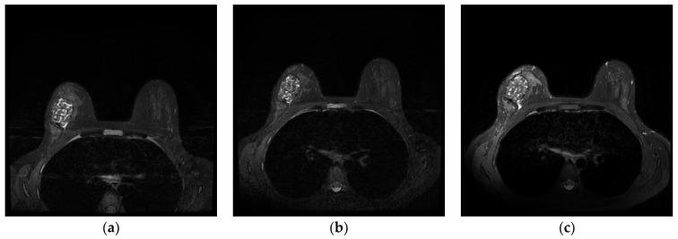 https://cdn.ncbi.nlm.nih.gov/pmc/blobs/f27e/12072617/2280190fd999/jcm-14-03002-g001.jpg