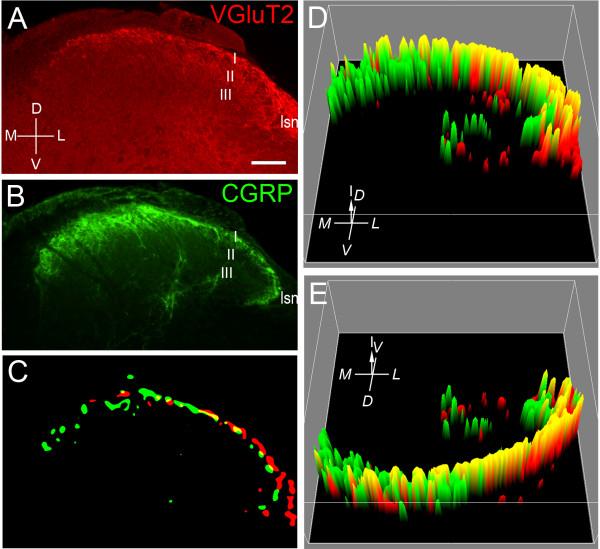 https://cdn.ncbi.nlm.nih.gov/pmc/blobs/f27e/3264520/53dac5caefe0/1744-8069-7-95-1.jpg