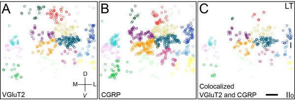 https://cdn.ncbi.nlm.nih.gov/pmc/blobs/f27e/3264520/7c6a6c76278c/1744-8069-7-95-7.jpg