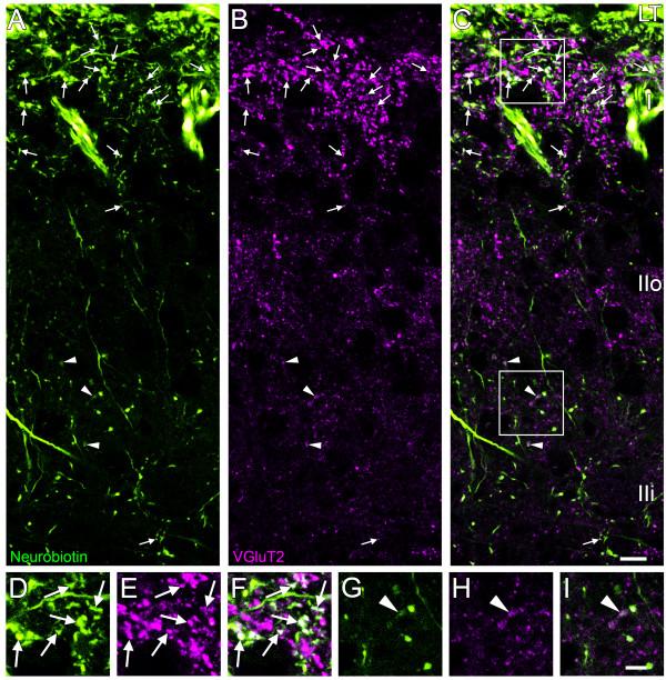 https://cdn.ncbi.nlm.nih.gov/pmc/blobs/f27e/3264520/eddd210d3c88/1744-8069-7-95-3.jpg