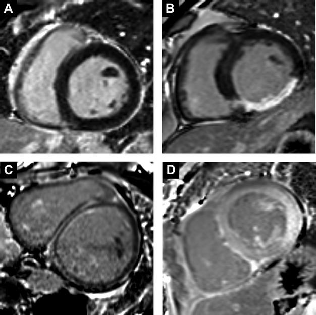 https://cdn.ncbi.nlm.nih.gov/pmc/blobs/f287/3886781/d1eab9f942ff/jah3-2-e000416-g2.jpg