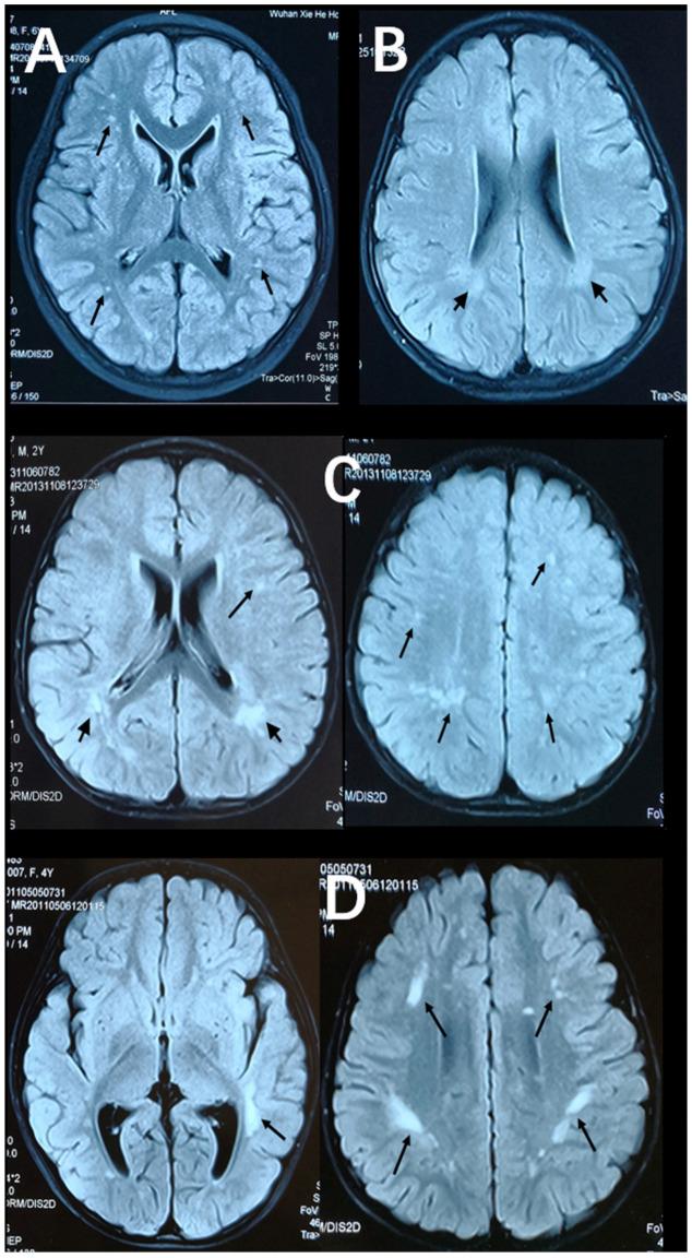 https://cdn.ncbi.nlm.nih.gov/pmc/blobs/f28a/10669646/15fd20254dd8/brainsci-13-01540-g003.jpg