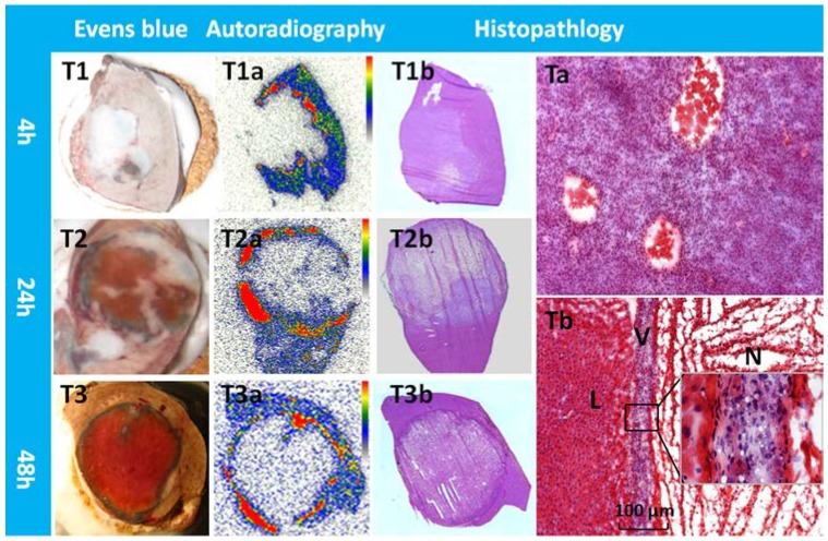 https://cdn.ncbi.nlm.nih.gov/pmc/blobs/f28a/3493203/784c6f2d26ce/thnov02p1010g05.jpg