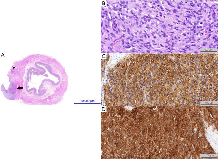 https://cdn.ncbi.nlm.nih.gov/pmc/blobs/f28b/10502532/a25b0abf8498/jgo-14-04-1887-f1.jpg