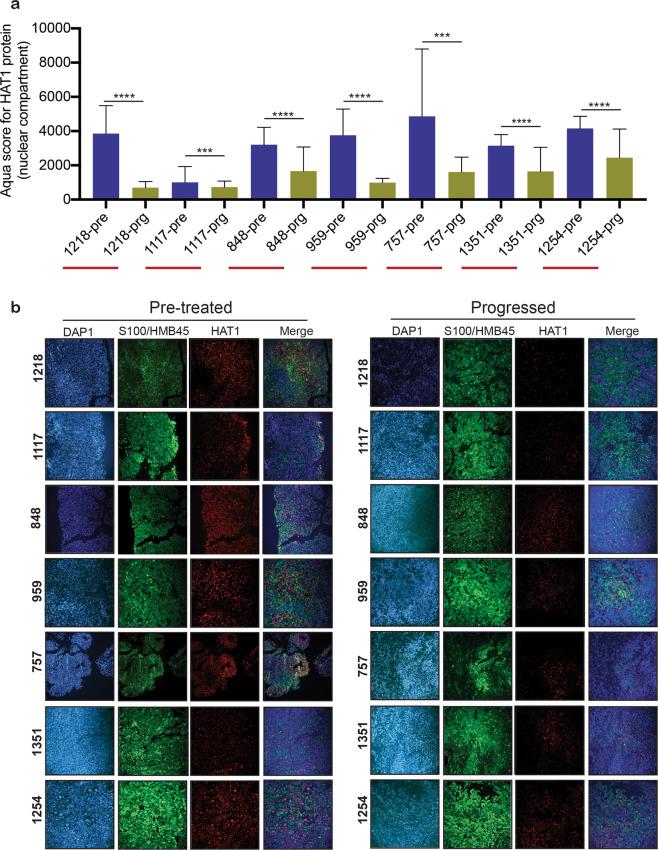 https://cdn.ncbi.nlm.nih.gov/pmc/blobs/f28b/7200761/8513ebd385af/41389_2020_228_Fig3_HTML.jpg