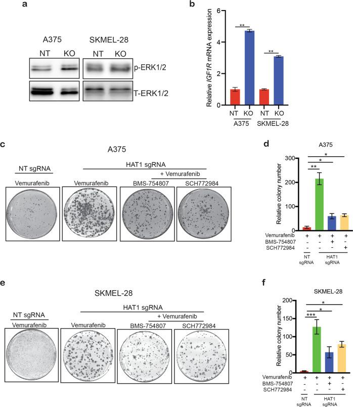 https://cdn.ncbi.nlm.nih.gov/pmc/blobs/f28b/7200761/8c810ac23b93/41389_2020_228_Fig6_HTML.jpg