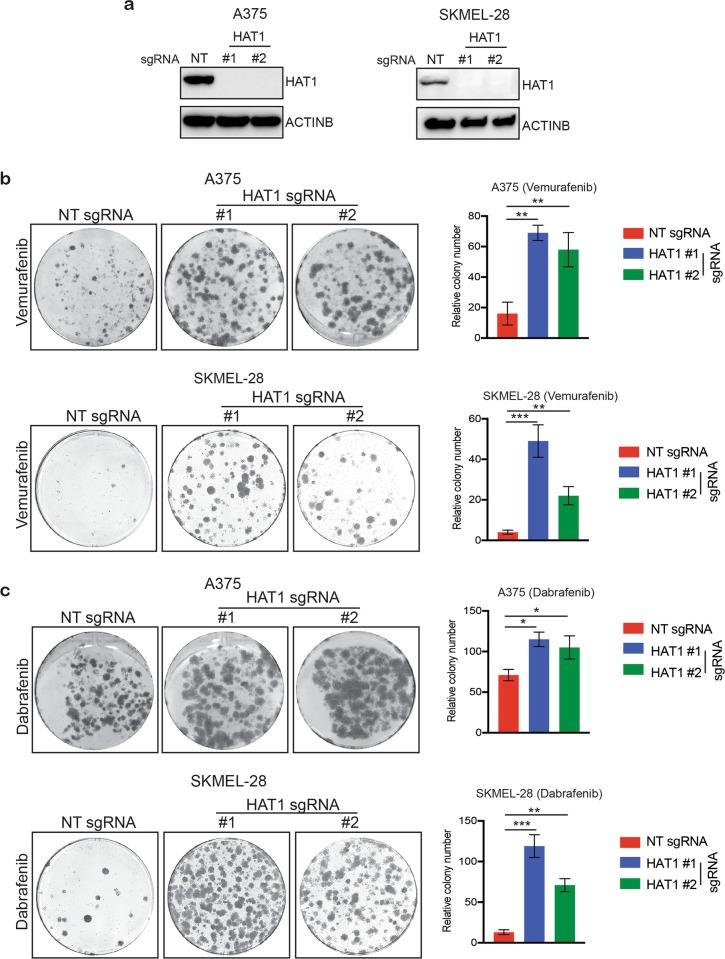 https://cdn.ncbi.nlm.nih.gov/pmc/blobs/f28b/7200761/d901def5396a/41389_2020_228_Fig2_HTML.jpg