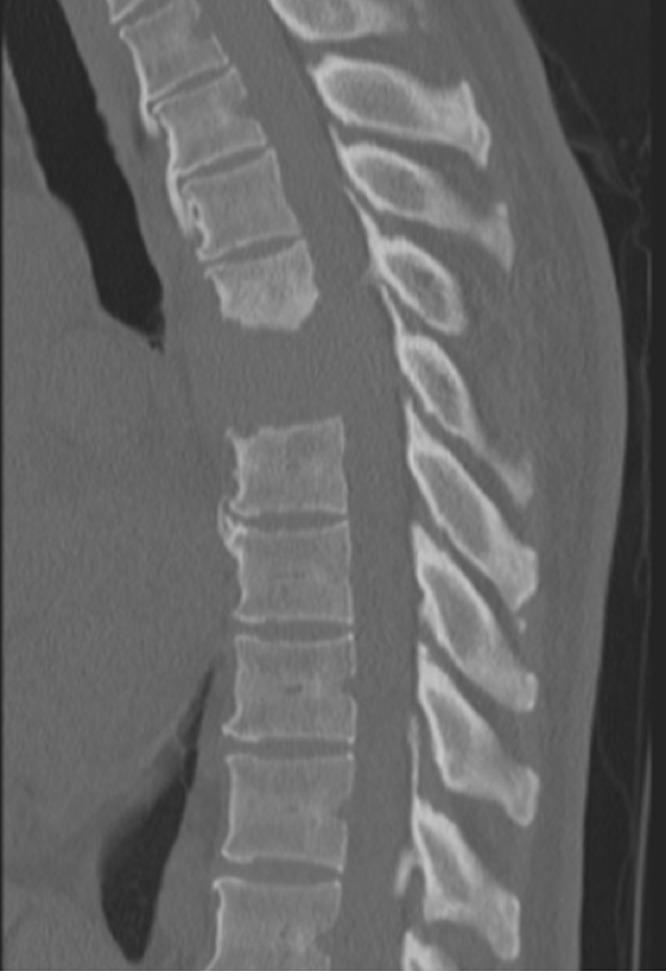 https://cdn.ncbi.nlm.nih.gov/pmc/blobs/f28c/5415380/1e26b13ea20f/cureus-0009-00000001132-i01.jpg