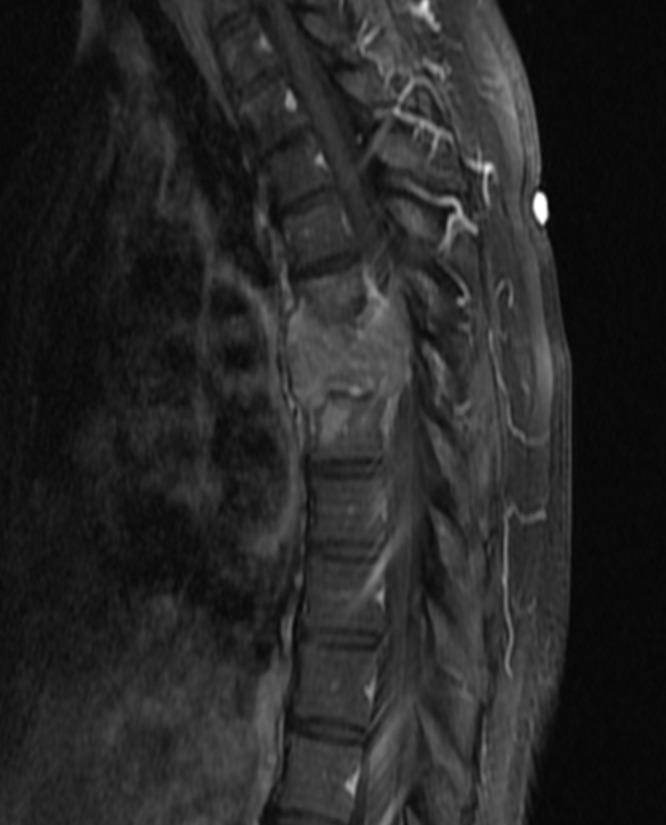 https://cdn.ncbi.nlm.nih.gov/pmc/blobs/f28c/5415380/4dd6cfb01996/cureus-0009-00000001132-i03.jpg