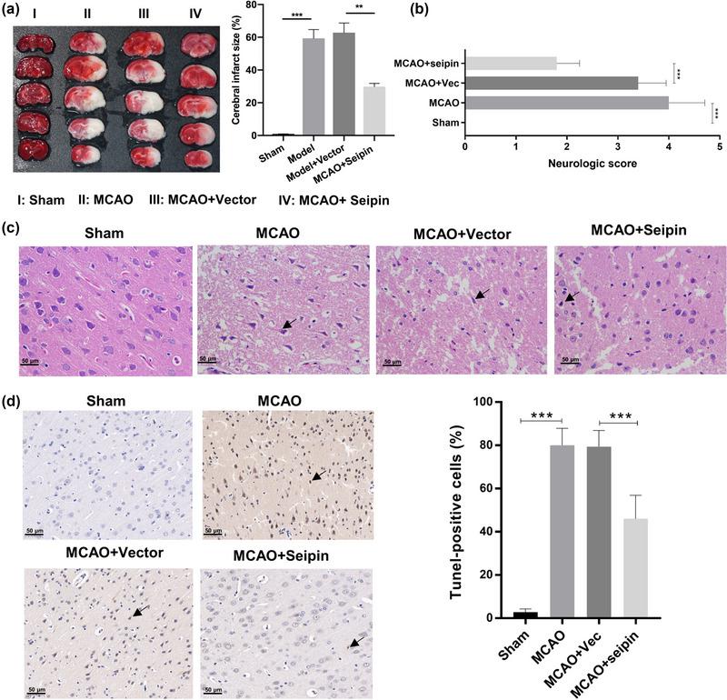 https://cdn.ncbi.nlm.nih.gov/pmc/blobs/f28e/10726895/6f63c36b7468/BRB3-13-e3195-g003.jpg