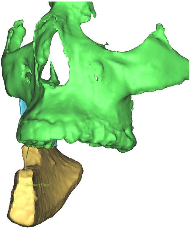 https://cdn.ncbi.nlm.nih.gov/pmc/blobs/f296/11321092/8d10a1419e14/13005_2024_444_Fig4_HTML.jpg