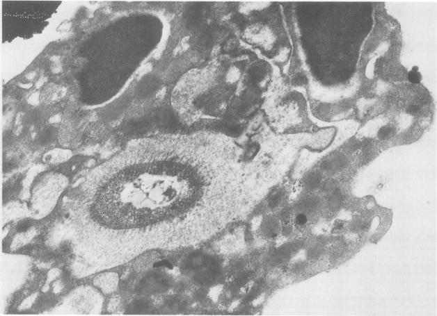 https://cdn.ncbi.nlm.nih.gov/pmc/blobs/f29a/259496/ace85aa38154/iai00080-0066-a.jpg