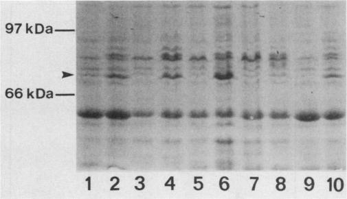 https://cdn.ncbi.nlm.nih.gov/pmc/blobs/f29c/258938/e5e87522ecde/iai00046-0349-a.jpg