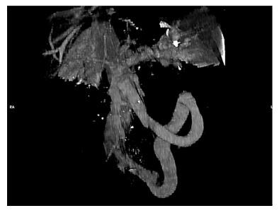 https://cdn.ncbi.nlm.nih.gov/pmc/blobs/f2a0/5743513/ea3d536e23be/WJG-23-8426-g001.jpg