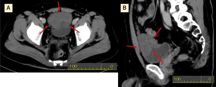 https://cdn.ncbi.nlm.nih.gov/pmc/blobs/f2a1/12179750/d52f12de4fde/cureus-0017-00000084520-i02.jpg