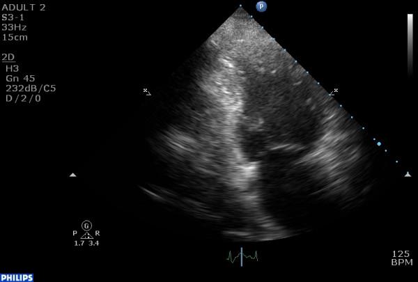https://cdn.ncbi.nlm.nih.gov/pmc/blobs/f2a1/2288610/a79a6bec18ca/1752-1947-2-74-3.jpg