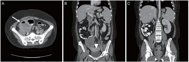 https://cdn.ncbi.nlm.nih.gov/pmc/blobs/f2a6/6962580/e9c32f318edd/ogs-63-98-g001.jpg