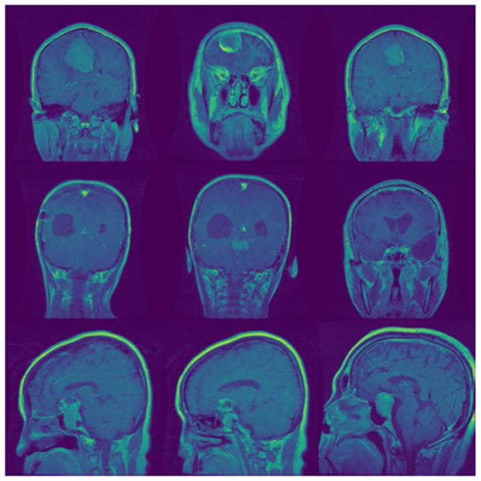 https://cdn.ncbi.nlm.nih.gov/pmc/blobs/f2a9/8869455/255e4ffc7606/biomedicines-10-00223-g001.jpg