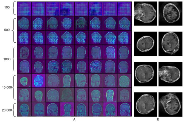 https://cdn.ncbi.nlm.nih.gov/pmc/blobs/f2a9/8869455/f8b29e9a4957/biomedicines-10-00223-g006.jpg