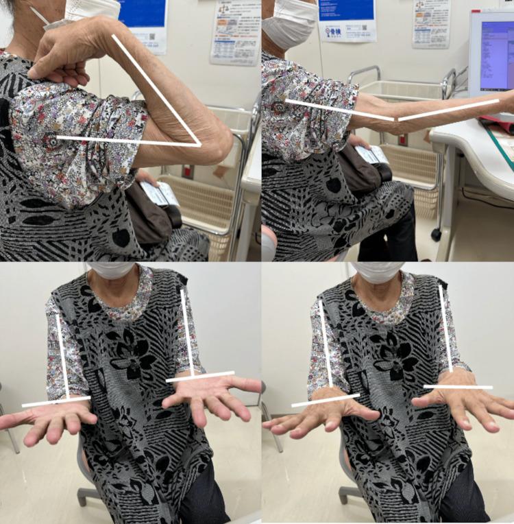 https://cdn.ncbi.nlm.nih.gov/pmc/blobs/f2ab/12049089/8ed05c4b51ce/cureus-0017-00000081653-i05.jpg