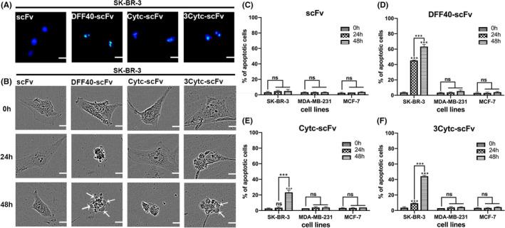https://cdn.ncbi.nlm.nih.gov/pmc/blobs/f2ab/8581304/2a9e8fa51859/JCMM-25-10638-g006.jpg