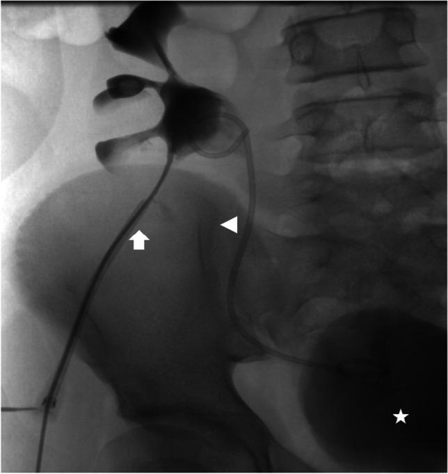 https://cdn.ncbi.nlm.nih.gov/pmc/blobs/f2ae/10027801/e8733574c9d2/247_2022_5558_Fig8_HTML.jpg
