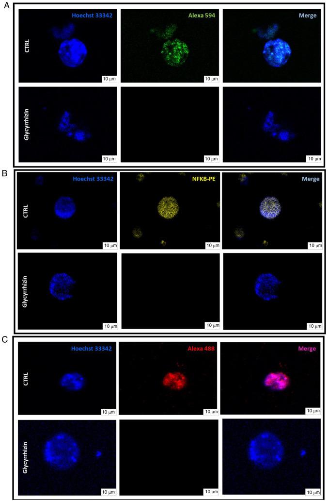 https://cdn.ncbi.nlm.nih.gov/pmc/blobs/f2af/12242370/f20222840d74/or-54-03-08939-g04.jpg
