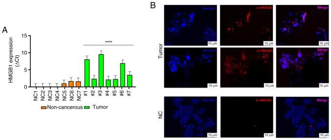 https://cdn.ncbi.nlm.nih.gov/pmc/blobs/f2af/12242370/f67b6b42d824/or-54-03-08939-g01.jpg
