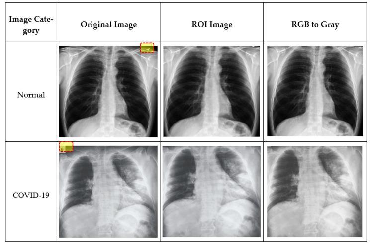 https://cdn.ncbi.nlm.nih.gov/pmc/blobs/f2b5/8078171/497f6790759e/sensors-21-01480-g004.jpg